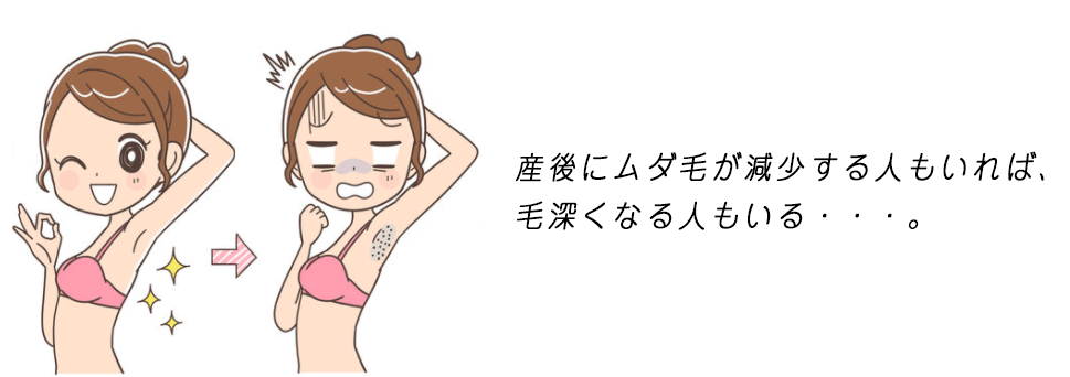 産後にムダ毛が薄くなる人もいれば、毛深くなる人も・・・。